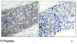 Anti-LIM kinase 2 (phospho Thr505) antibody used in IHC (Paraffin sections) (IHC-P). GTX79022