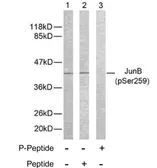 Anti-JunB (phospho Ser259) antibody used in Western Blot (WB). GTX79027