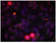Anti-ELK1 (phospho Thr417) antibody used in Immunocytochemistry/ Immunofluorescence (ICC/IF). GTX79085