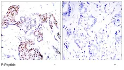 Anti-ELK1 (phospho Ser389) antibody used in IHC (Paraffin sections) (IHC-P). GTX79086