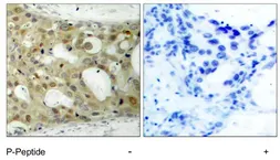 Anti-Androgen Receptor (phospho Ser650) antibody used in IHC (Paraffin sections) (IHC-P). GTX79139