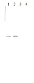 Anti-Prothrombin antibody [9013] used in Western Blot (WB). GTX79651