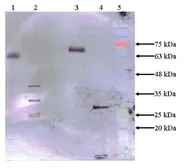 Anti-Factor IX antibody [13F42-F6] used in Western Blot (WB). GTX79803