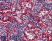 Anti-HLA-E antibody [MEM-E/07] (Biotin) used in IHC (Paraffin sections) (IHC-P). GTX79922