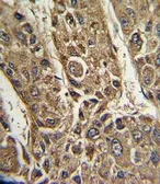 Anti-MTTP antibody, C-term used in IHC (Paraffin sections) (IHC-P). GTX80580