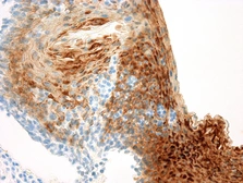 Anti-Cytokeratin 13 antibody [KS-1A3] used in IHC (Paraffin sections) (IHC-P). GTX80652