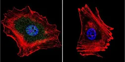 Anti-Progesterone Receptor (phospho Ser294) antibody [608] used in Immunocytochemistry/ Immunofluorescence (ICC/IF). GTX80698