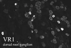 Anti-VR1/ TRPV1 antibody used in IHC (Frozen sections) (IHC-Fr). GTX80798