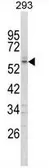 Anti-FOXC1 antibody, C-term used in Western Blot (WB). GTX80948