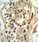 Anti-ABHD12 antibody, N-term used in IHC (Paraffin sections) (IHC-P). GTX80950