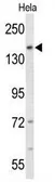 Anti-FNDC3B antibody, N-term used in Western Blot (WB). GTX81041