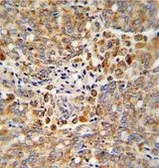 Anti-ALKBH3 antibody, C-term used in IHC (Paraffin sections) (IHC-P). GTX81095