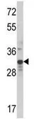 Anti-MLX antibody, Internal used in Western Blot (WB). GTX81125