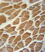Anti-ACADL antibody, Internal used in IHC (Paraffin sections) (IHC-P). GTX81189