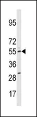 Anti-CYP11A1 antibody, N-term used in Western Blot (WB). GTX81242