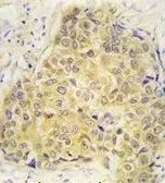 Anti-Semaphorin 3A antibody, Internal used in IHC (Paraffin sections) (IHC-P). GTX81310