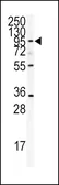 Anti-ADAMTS13 antibody, Internal used in Western Blot (WB). GTX81447