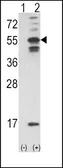 Anti-CaMKII alpha antibody, C-term used in Western Blot (WB). GTX81466