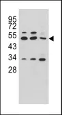 Anti-CPA4 antibody, C-term used in Western Blot (WB). GTX81517