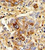 Anti-CD163 antibody, N-term used in IHC (Paraffin sections) (IHC-P). GTX81526