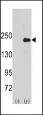 Anti-JLP antibody, Internal used in Western Blot (WB). GTX81547