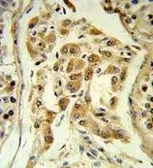 Anti-ESPN antibody, N-term used in IHC (Paraffin sections) (IHC-P). GTX81675