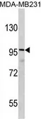 Anti-DLGAP1 antibody, N-term used in Western Blot (WB). GTX81689