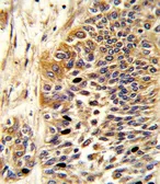 Anti-Wnt4 antibody, Internal used in IHC (Paraffin sections) (IHC-P). GTX81775