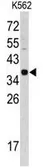 Anti-Cathepsin E antibody, Internal used in Western Blot (WB). GTX81837