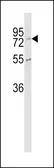 Anti-CPZ antibody, N-term used in Western Blot (WB). GTX81852