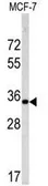 Anti-Emerin antibody, C-term used in Western Blot (WB). GTX81870