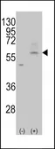 Anti-SLC29A4 antibody, C-term used in Western Blot (WB). GTX82546