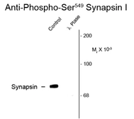 Anti-Synapsin I (phospho Ser549) antibody used in Western Blot (WB). GTX82590