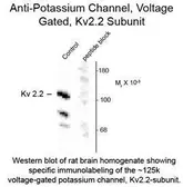 Anti-Kv2.2 antibody used in  (). GTX82610
