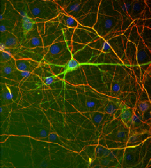 Anti-NF-H antibody used in Immunocytochemistry/ Immunofluorescence (ICC/IF). GTX82646