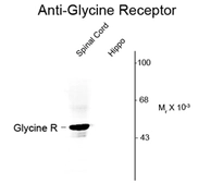 Anti-Glycine Receptor antibody used in Western Blot (WB). GTX82665