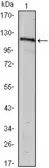 Anti-USP7 antibody [5F11] used in Western Blot (WB). GTX82802