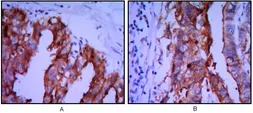 Anti-Placental Alkaline Phosphatase antibody [3E5] used in IHC (Paraffin sections) (IHC-P). GTX82823