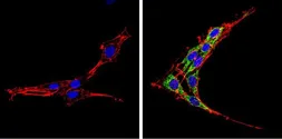 Anti-SREBP2 antibody used in Immunocytochemistry/ Immunofluorescence (ICC/IF). GTX82865