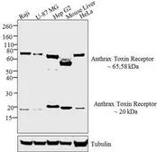 Anti-TEM8 antibody used in Western Blot (WB). GTX82869