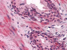 Anti-Lipocalin 1 antibody [10B10] used in IHC (Paraffin sections) (IHC-P). GTX83128