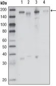 Anti-RON antibody [1B5A9] used in Western Blot (WB). GTX83174