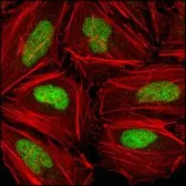 Anti-Chk2 antibody [1C12B8] used in Immunocytochemistry/ Immunofluorescence (ICC/IF). GTX83198