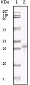 Anti-KSHV ORF26 antibody [2F6B8] used in Western Blot (WB). GTX83244