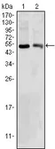 Anti-BDH1 antibody [1A5] used in Western Blot (WB). GTX83270