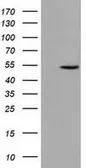 Anti-UHMK1 antibody [5E10] used in Western Blot (WB). GTX83440