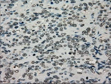 Anti-TYRO3 antibody [5B4] used in IHC (Paraffin sections) (IHC-P). GTX83459