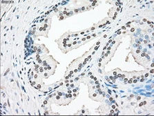 Anti-SSB antibody [9D6] used in IHC (Paraffin sections) (IHC-P). GTX83557