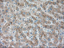 Anti-alpha 1 Antitrypsin antibody [11G2] used in IHC (Paraffin sections) (IHC-P). GTX83663