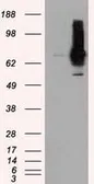 Anti-RALBP1 antibody [11B2] used in Western Blot (WB). GTX83728